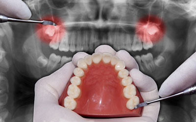Oral & Maxillofacial Surgery Department